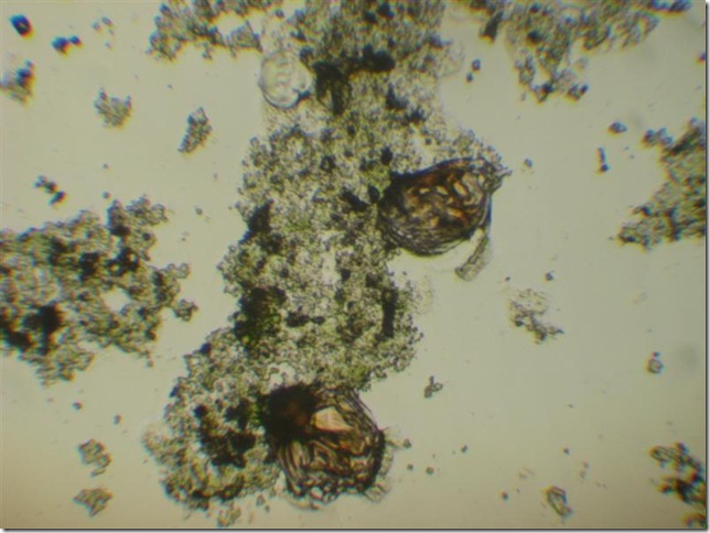 rotiferos 001 (Medium)